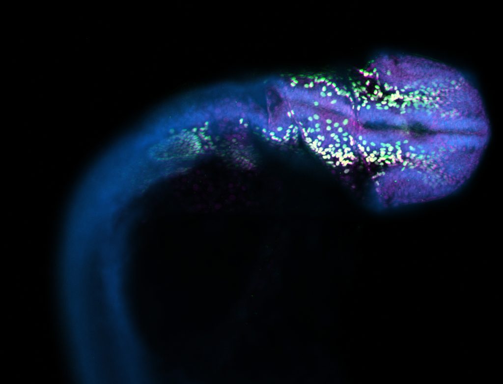 The digital photograph of the human embryo at the earliest stages.